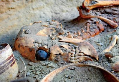 چشم مصنوعی در بهترین حالت نگهداری ماند